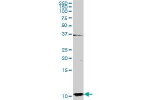 S100A2 MaxPab rabbit polyclonal antibody. (S100A2 anticorps  (AA 1-97))