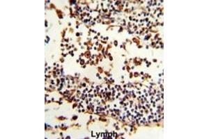 Immunohistochemistry (IHC) image for anti-Immunoglobulin Heavy Constant alpha 1 (IGHA1) antibody (ABIN3003223) (IGHA1 anticorps)
