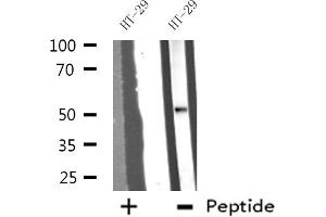 Western blot analysis of extracts from HT-29 cells, using DDX19B antibody. (DDX19B anticorps  (N-Term))