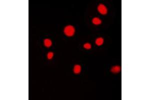 Immunofluorescent analysis of ATRIP staining in MCF7 cells. (ATRIP anticorps  (N-Term))