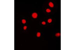 Immunofluorescent analysis of ATRIP staining in MCF7 cells.