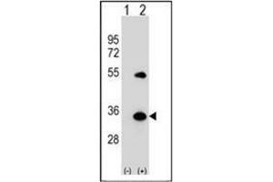 Western blot analysis of APG5L (arrow) using ATG5 Antibody (N-term) Cat.
