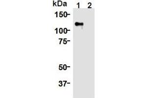 Western Blotting (WB) image for anti-Kinesin Family Member 11 (KIF11) (AA 1-1056), (N-Term) antibody (ABIN1449288) (KIF11 anticorps  (N-Term))