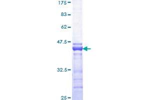Image no. 1 for CREB Binding Protein (CREBBP) (AA 951-1050) protein (GST tag) (ABIN1350309)