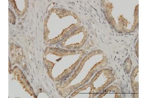 Immunoperoxidase of monoclonal antibody to TUBA1B on formalin-fixed paraffin-embedded human prostate. (TUBA1B anticorps  (AA 1-451))