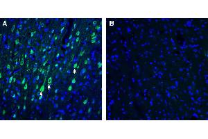 Expression of CART in rat parietal cortex.