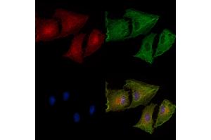 Phospho-IP3 Receptor (Ser1764) Antibody staining A549 cells(heat shock treatment) by IF/ICC. (IP3 Receptor anticorps  (pSer1764))