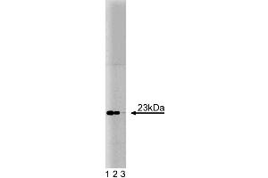 Western blot analysis of Bad on an A431 cell lysate (Human epithelial carcinoma, ATCC CRL-1555). (BAD anticorps  (AA 39-198))
