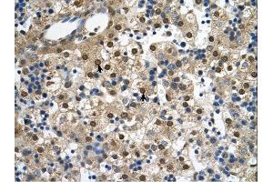 Immunohistochemistry (IHC) image for anti-Squalene Epoxidase (SQLE) (C-Term) antibody (ABIN2777142)