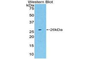 Detection of Recombinant LMP7, Mouse using Polyclonal Antibody to Large Multifunctional Peptidase 7 (LMP7)