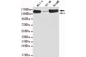 Western blot detection of SMC1A(C-term) in MOLT-4,U87 MG and HelaNE cell lysates using SMC1A (N-terminus) mouse mAb (1:1000 diluted). (SMC1A anticorps  (C-Term))