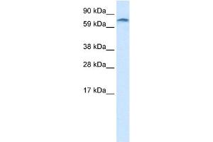 WB Suggested Anti-ZNF84 Antibody Titration:  1. (ZNF84 anticorps  (C-Term))