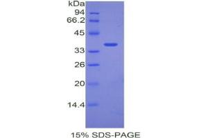 SDS-PAGE analysis of Mouse ANGPTL7 Protein. (ANGPTL7 Protéine)