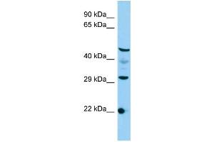 Host: Rabbit Target Name: C3orf26 Sample Type: HepG2 Whole Cell lysates Antibody Dilution: 1. (CMSS1 anticorps  (N-Term))
