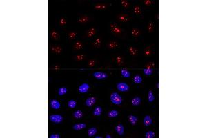 Confocal immunofluorescence analysis of U2OS cells using MYBBP1A Polyclonal Antibody (ABIN1680938, ABIN3018915, ABIN3018916 and ABIN6220628) at dilution of 1:200.