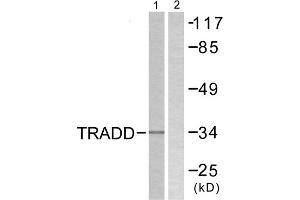 Western blot analysis of extracts from COS7 cells, using TRADD antibody. (TRADD anticorps  (C-Term))