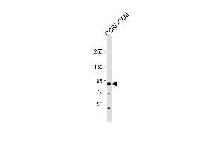 Anti-MDM2 Antibody  at1:2000 dilution + CCRF-CEM whole cell lysate Lysates/proteins at 20 μg per lane. (MDM2 anticorps  (AA 141-176))