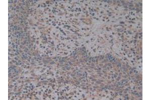 anti-Complement Factor H (CFH) (AA 860-1231) antibody