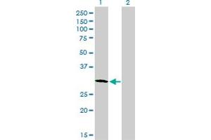 Western Blot analysis of PLSCR3 expression in transfected 293T cell line by PLSCR3 monoclonal antibody (M09), clone 2C8. (PLSCR3 anticorps  (AA 1-295))