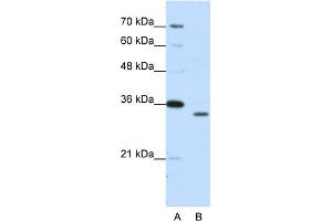 WB Suggested Anti-PSMA1 Antibody Titration:  1. (PSMA1 anticorps  (N-Term))