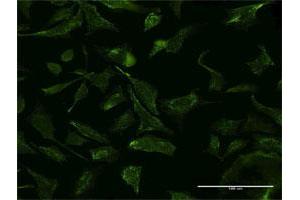 Immunofluorescence of monoclonal antibody to VCP on HeLa cell.