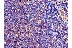 Immunohistochemistry of paraffin-embedded human lymph node tissue using ABIN7147139 at dilution of 1:100