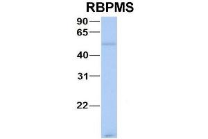 Host:  Rabbit  Target Name:  CHAD  Sample Type:  Human Adult Placenta  Antibody Dilution:  1. (RBPMS anticorps  (N-Term))