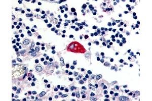 Anti-EMR3 antibody IHC of human macrophage.