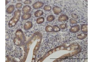 Immunoperoxidase of monoclonal antibody to TYK2 on formalin-fixed paraffin-embedded human small Intestine.