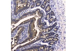 IHC testing of FFPE mouse small intestine tissue with COX4I1 antibody at 1ug/ml. (COX IV anticorps)