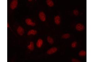 IF analysis of SDE2 using anti-SDE2 antibody (ABIN7599603). (C1orf55 anticorps  (AA 10-447))