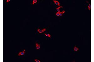 ABIN6269244 staining HeLa cells by IF/ICC. (MAP3K8 anticorps  (Internal Region))