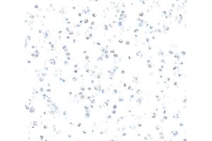 Immunocytochemistry (ICC) image for anti-Zinc Finger E-Box Binding Homeobox 1 (ZEB1) (AA 750-800) antibody (ABIN7455173) (Recombinant ZEB1 anticorps  (AA 750-800))