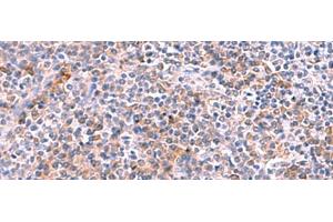 Immunohistochemistry of paraffin-embedded Human tonsil tissue using NCAN Polyclonal Antibody at dilution of 1:30(x200) (Neurocan anticorps)