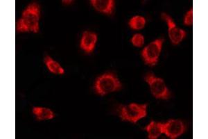 ABIN6274563 staining HepG2 by IF/ICC.