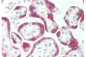 Rabbit Anti-PSG5 antibody  Formalin Fixed Paraffin Embedded Tissue: Human Placenta Primary antibody Concentration: 1:100 Secondary Antibody: Donkey anti-Rabbit-Cy3 Secondary Antibody Concentration: 1:200 Magnification: 20x Exposure Time: 0. (PSG5 anticorps  (Middle Region))