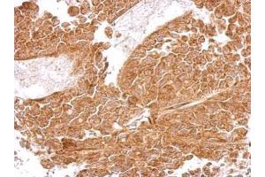 IHC-P Image MRPS5 antibody detects MRPS5 protein at cytosol on AGS xenograft by immunohistochemical analysis.