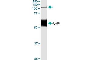 Immunoprecipitation of NOD2 transfected lysate using anti-NOD2 MaxPab rabbit polyclonal antibody and Protein A Magnetic Bead , and immunoblotted with NOD2 MaxPab rabbit polyclonal antibody (D01) .