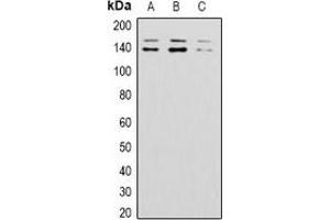 Western blot analysis of BAI1 expression in 293T (A), mouse brain (B), rat brain (C) whole cell lysates. (BAI1 anticorps)