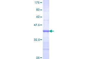 Image no. 1 for Nuclear Receptor Subfamily 2, Group E, Member 1 (NR2E1) (AA 249-342) protein (GST tag) (ABIN1312958)