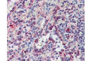 IHC Information: Spleen, Human: Formalin-Fixed, Paraffin-Embedded (FFPE) (CYBB anticorps  (C-Term))