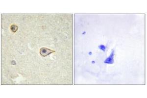 Immunohistochemistry (IHC) image for anti-Cytochrome P450, Family 19, Subfamily A, Polypeptide 1 (CYP19A1) antibody (ABIN1850333) (Aromatase anticorps)
