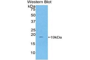 Western Blotting (WB) image for anti-Haptoglobin (HP) (AA 168-319) antibody (ABIN1859196) (Haptoglobin anticorps  (AA 168-319))