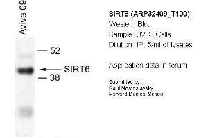 anti-Sirtuin 6 (SIRT6) (N-Term) antibody
