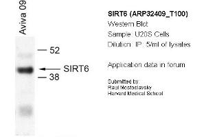 Image no. 1 for anti-Sirtuin 6 (SIRT6) (N-Term) antibody (ABIN2779625) (SIRT6 anticorps  (N-Term))