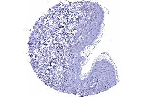 Skin Weak nuclear p53 immunostaining of a fraction of basal and suprabasal cells p53 immunohistochemistry scaled