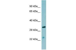WB Suggested Anti-MASP2  Antibody Titration: 0. (MASP2 anticorps  (N-Term))