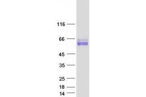 Validation with Western Blot