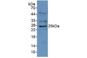 Figure. (EBI3 anticorps  (AA 21-229))