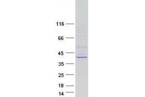 Validation with Western Blot